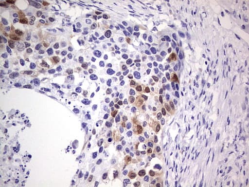 p16INK4a / CDKN2A Antibody (clone OTI2C5)