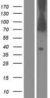 Human DMD / Dystrophin Protein (Over-Expression Lysate Myc-DDK (Flag))