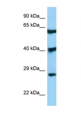 DKK3 Antibody (aa51-100)