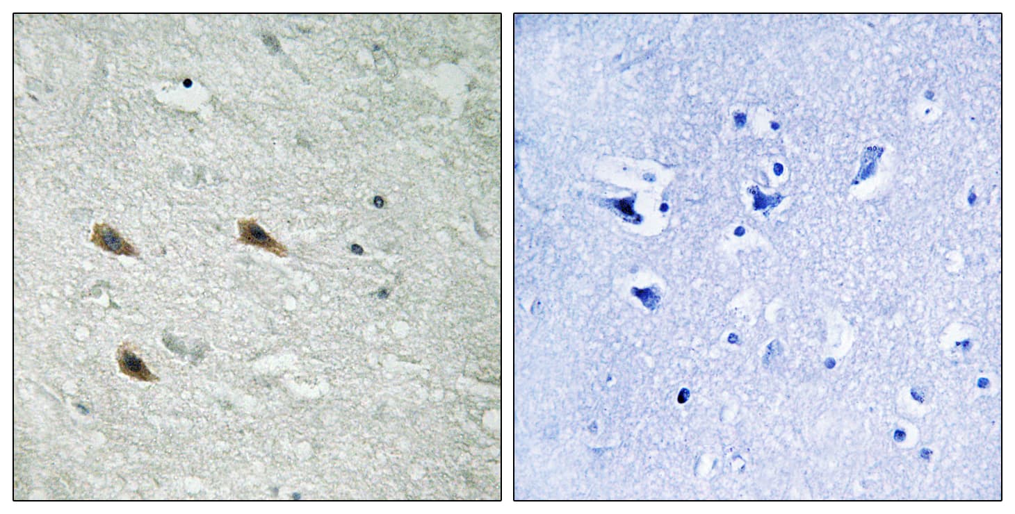 Polyclonal Rabbit anti-Human RAF1 / RAF Antibody (phospho-Ser289, IHC)