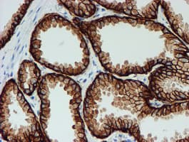 Monoclonal Mouse anti-Human FXYD3 Antibody (clone OTI1E8, IHC, IF, WB)