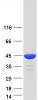 Human MVK Protein (Recombinant Myc-DDK (Flag))