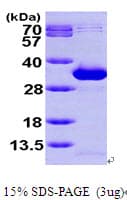 Human NANP Protein (Recombinant His)