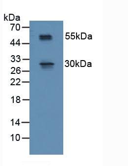 RSPO1 / RSPO Antibody (aa21-135)