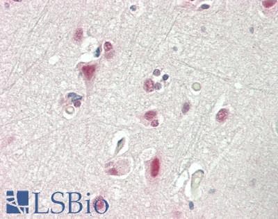 IHC-plus™ PSMC2 / RPT1 Antibody (aa150-200)