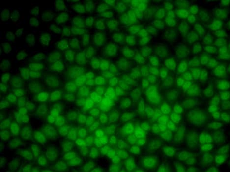 UMPS / OPRT Antibody