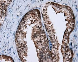RIP1 / RALBP1 Antibody (clone OTI6E8)