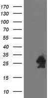 HSPB7 / CvHSP Antibody (clone OTI1D11, Carrier-free)