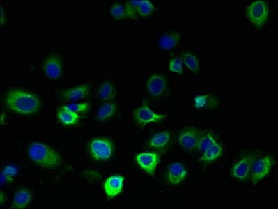FAM156A / TMEM29 Antibody