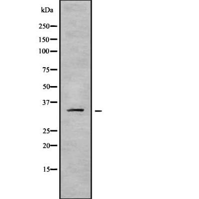 HOXA11 Antibody