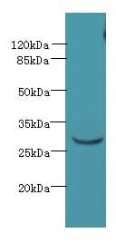 CCDC127 Antibody (Coiled-coil domain)
