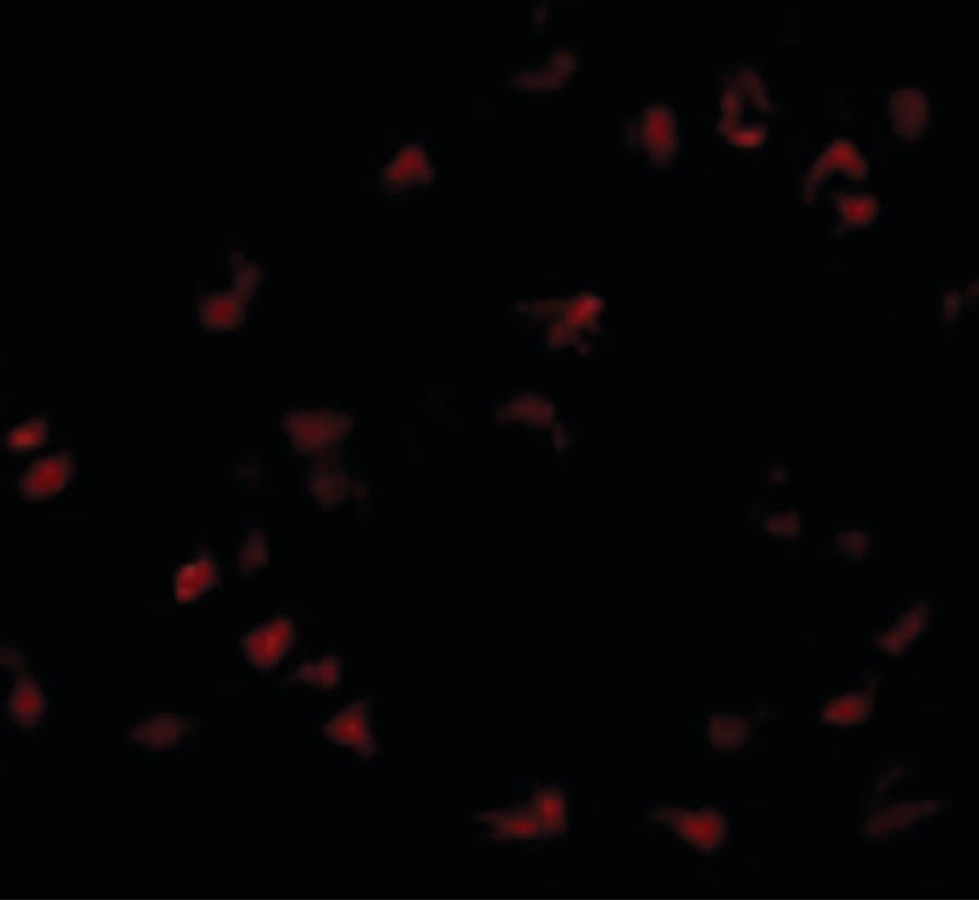 IHC-plus™ GNPDA1 Antibody