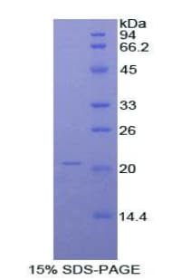 Rat ORM1 / Orosomucoid Protein (Recombinant His)