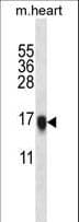 IHC-plus™ Polyclonal Rabbit anti-Human VILIP / VSNL1 Antibody (aa47-75, IHC, WB)