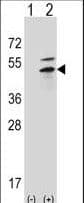 Polyclonal Rabbit anti-Human PRKAR2B Antibody (aa32-62, WB)