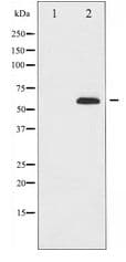 FOXO4 / AFX1 Antibody