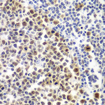 Polyclonal Rabbit anti-Human MSH6 Antibody (IHC, IF, WB)