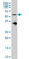 EYA2 Antibody (clone 2F8)