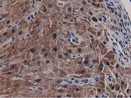 SQSTM1 Antibody (clone OTI4A12, Carrier-free)