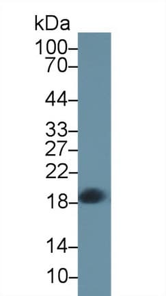CPLX2 / Complexin 2 Antibody (aa2-134)