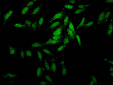 ESRP2 / RBM35B Antibody