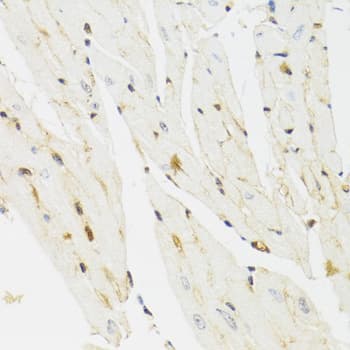 THAP1 Antibody (AP)