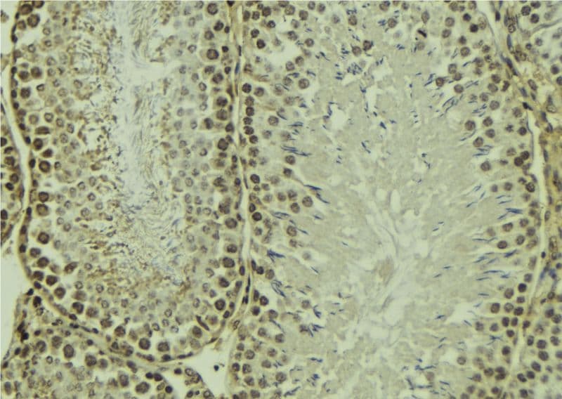 ITGB3 / Integrin Beta 3 / CD61 Antibody