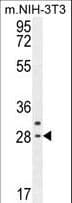 CLDN22 / Claudin 22 Antibody (aa90-117)