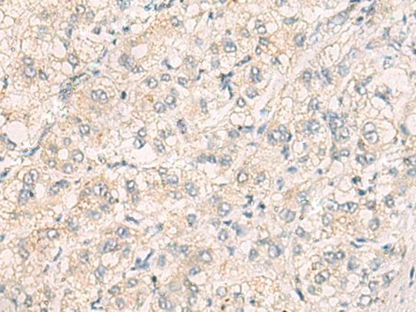 THG1L Antibody