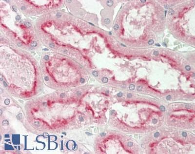 IHC-plus™ TASP / LANCL2 Antibody