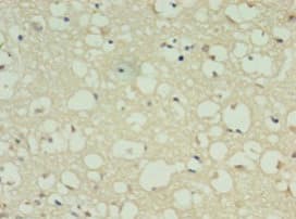 DRD5 / Dopamine Receptor D5 Antibody (aa361-477)