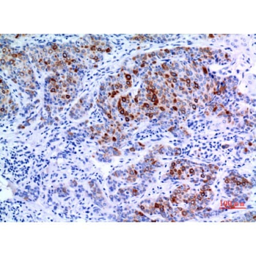 Polyclonal Rabbit anti-Human Pan Cytokeratin Antibody (IHC, WB)