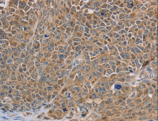 NDUFS7 Antibody
