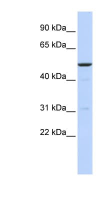 Polyclonal Rabbit anti-Human BTBD3 Antibody (N-Terminus, WB)