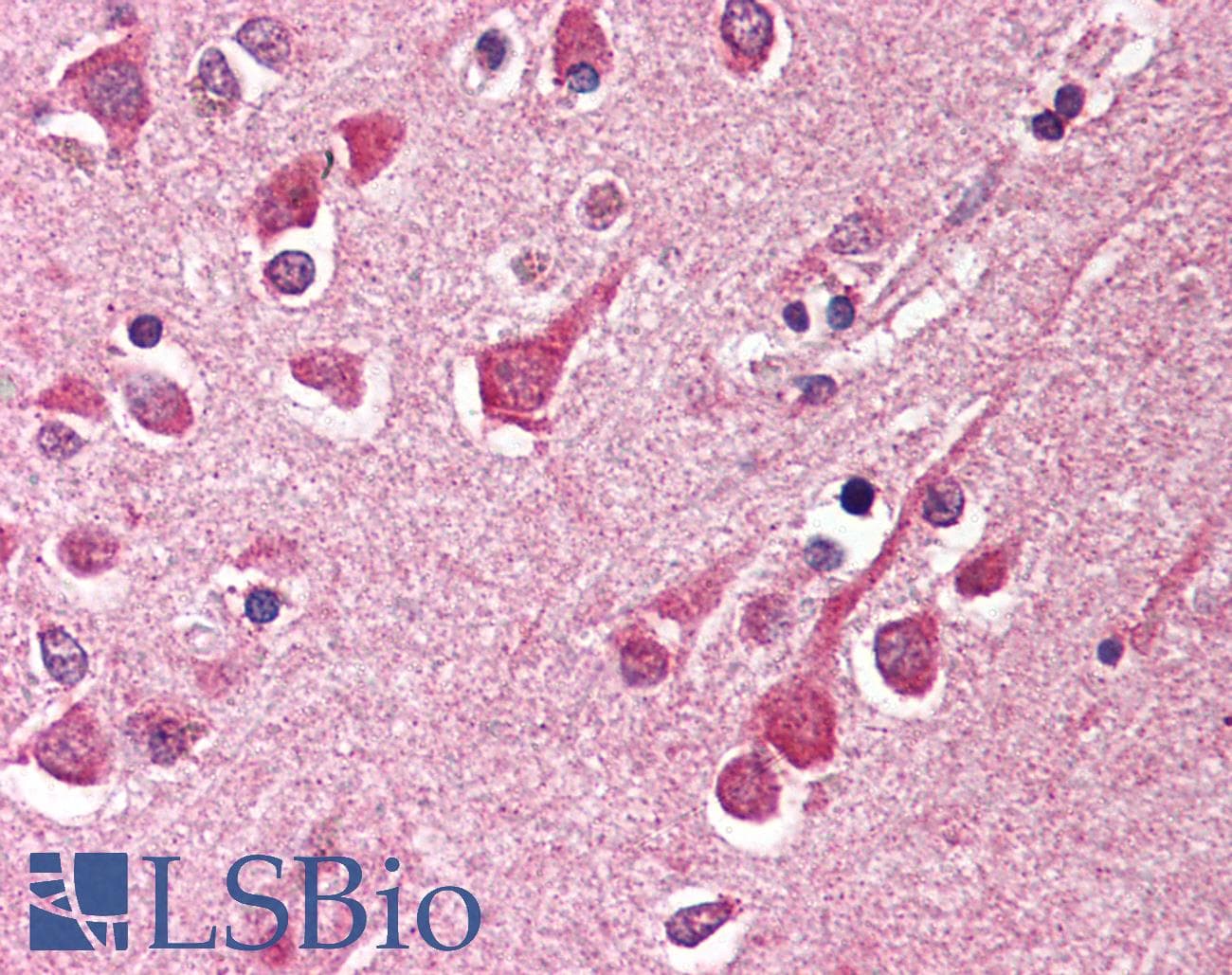 IHC-plus™ Raptor / Mip1 Antibody