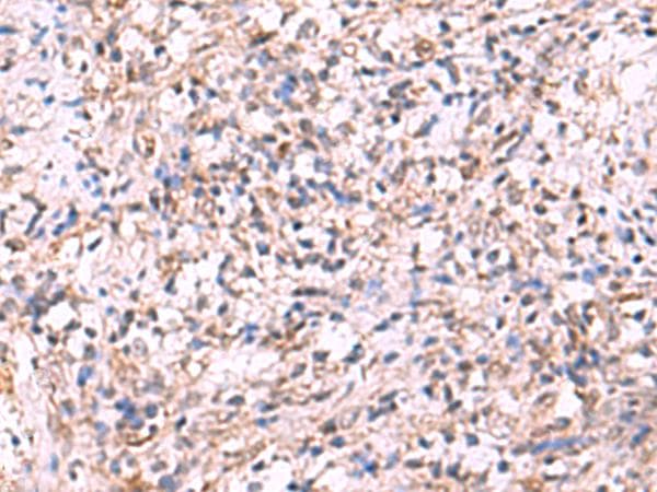 Polyclonal Rabbit anti-Human LMCD1 Antibody (IHC, WB)