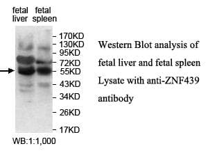 ZNF439 Antibody (aa14-295)