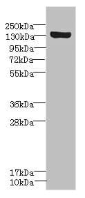 SCN8A / Nav1.6 Antibody