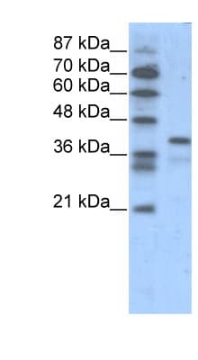 Polyclonal Rabbit anti-Human POU5F1 / OCT4 Antibody (aa114-163, IHC, WB)