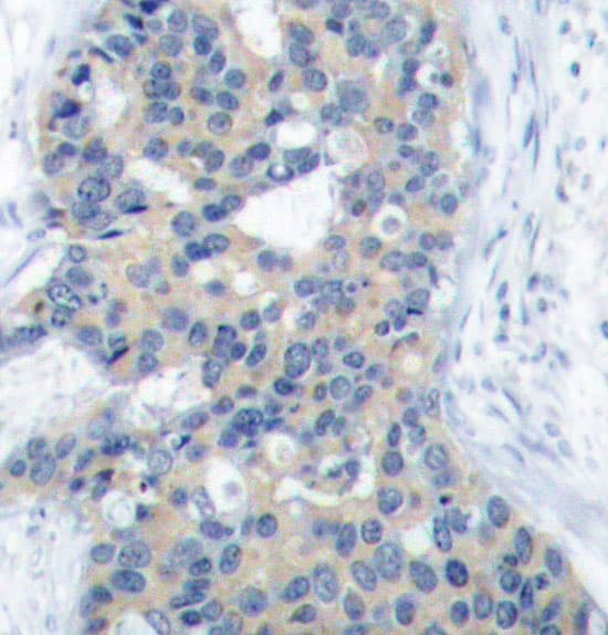 STMN1 / Stathmin / LAG Antibody (phospho-Ser38)