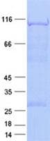 Human SMARCAL1 Protein (Recombinant His, N-Terminal)