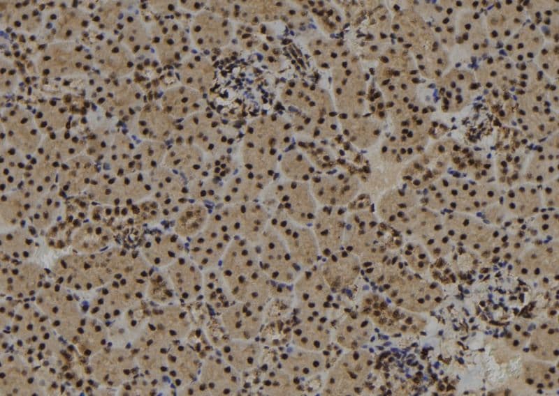 Polyclonal Rabbit anti-Human SYNPO2 / Synaptopodin 2 Antibody (IHC, WB)