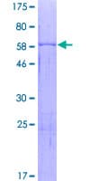 Human SMPD1 / Acid Sphingomyelinase Protein (Recombinant GST)