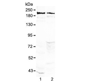 Polyclonal Rabbit anti-Human NCAN / Neurocan Antibody (IHC, WB)