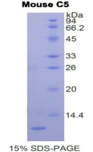 Mouse Complement C5 Protein (Recombinant His, N-Terminal)