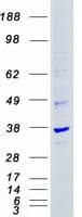 Human CDK4 Protein (Recombinant Myc-DDK (Flag))