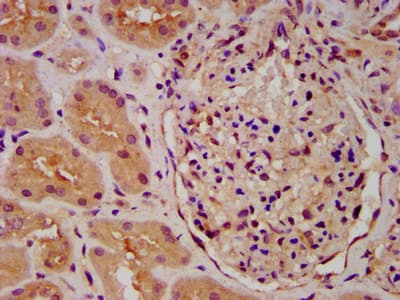 PICALM / CALM Antibody