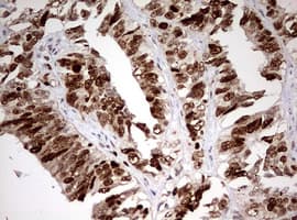 Monoclonal Mouse anti-Human TOP2A / Topoisomerase II Alpha Antibody (clone OTI2D12, aa1100-1531, IHC, WB)