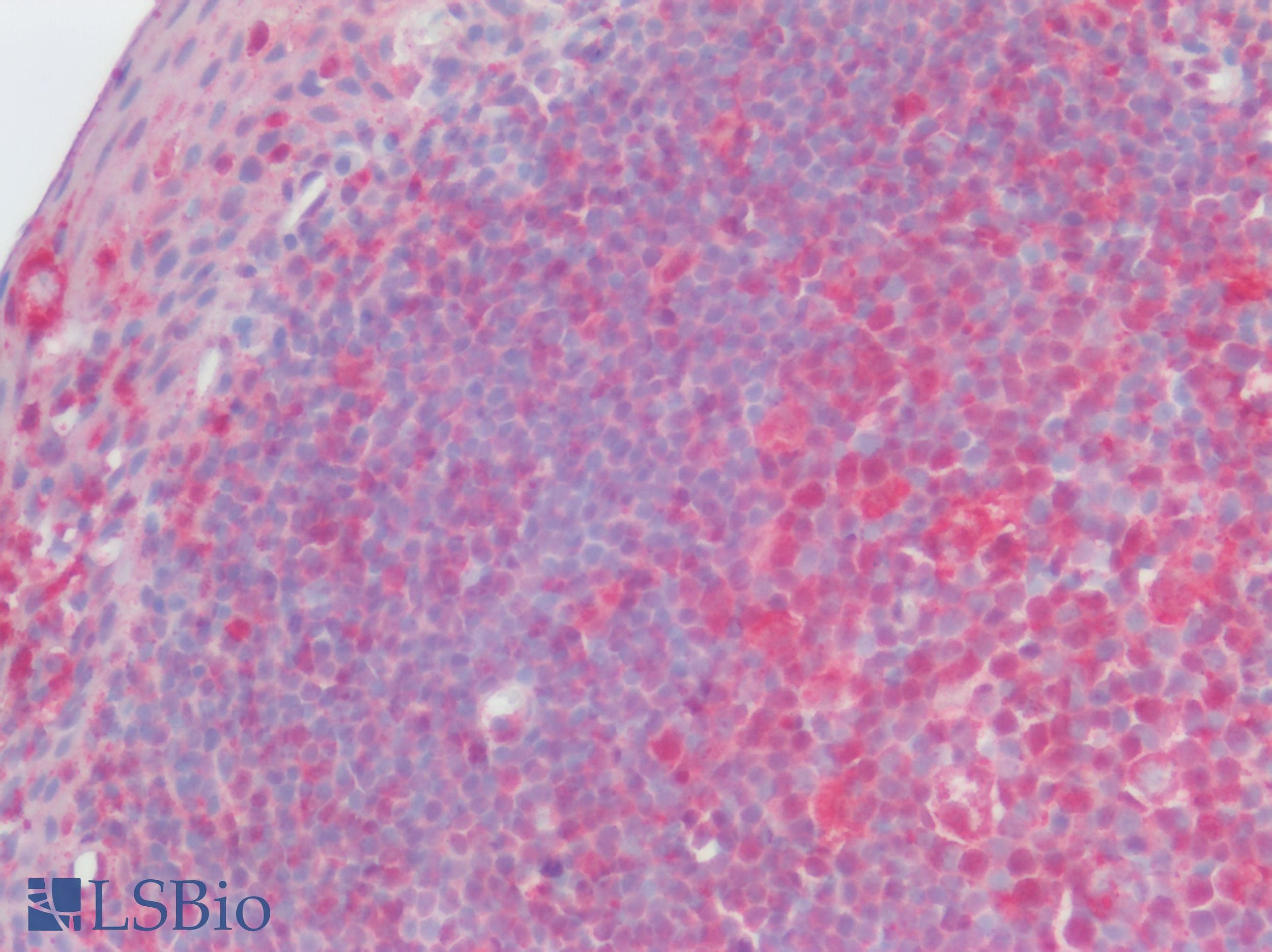 IHC-plus™ Polyclonal Rabbit anti-Human CCR2 Antibody (N-Terminus, IHC)