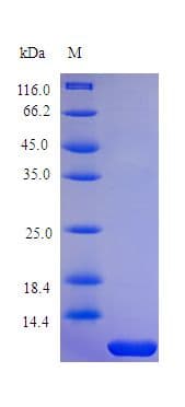 Human PTH / Parathyroid Hormone Protein (Recombinant)